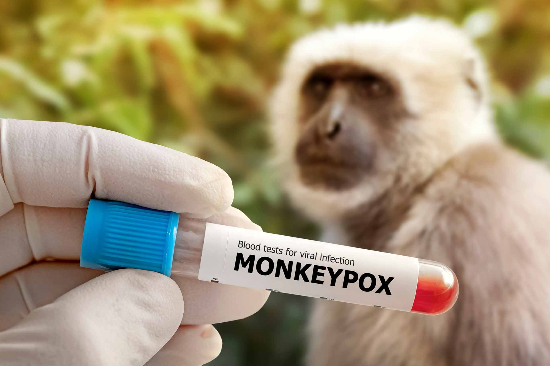 los-casos-globales-de-viruela-del-mono-superan-los-26000